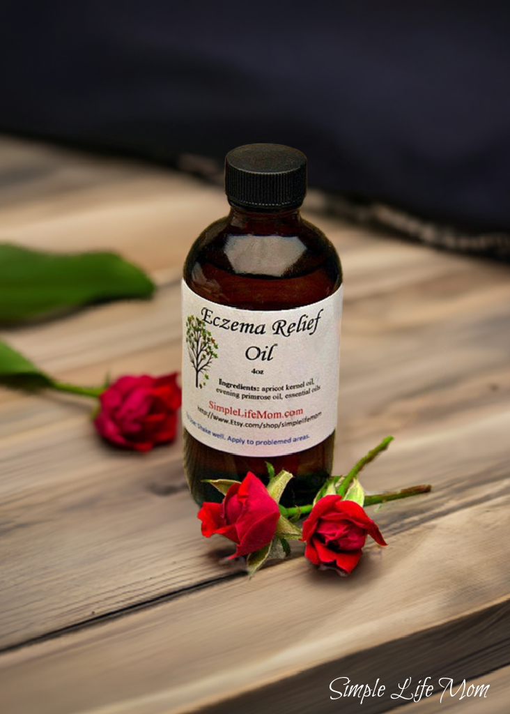 ECZEMA RELIEF OIL - 4oz soothe irritated, dry skin, organic body oil with essential oils, dermatitis oil