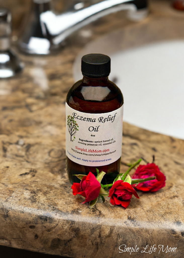 ECZEMA RELIEF OIL - 4oz soothe irritated, dry skin, organic body oil with essential oils, dermatitis oil