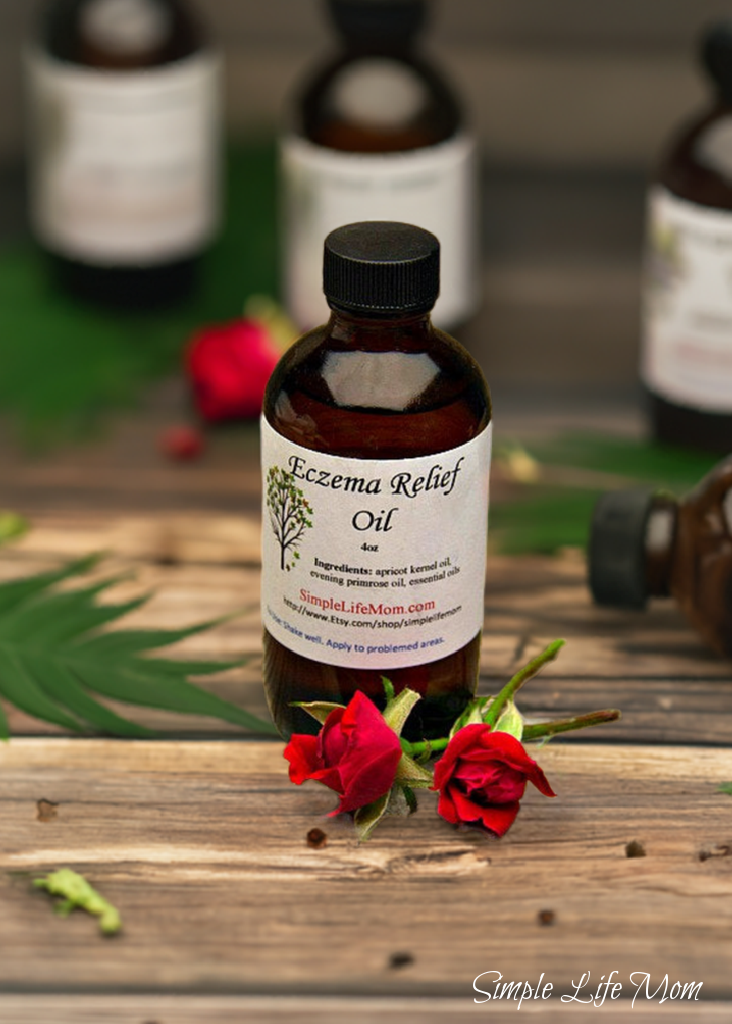 ECZEMA RELIEF OIL - 4oz soothe irritated, dry skin, organic body oil with essential oils, dermatitis oil