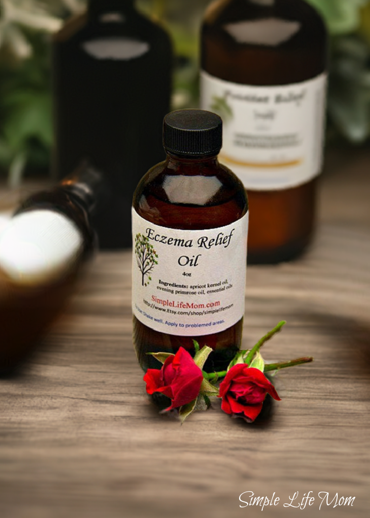 ECZEMA RELIEF OIL - 4oz soothe irritated, dry skin, organic body oil with essential oils, dermatitis oil