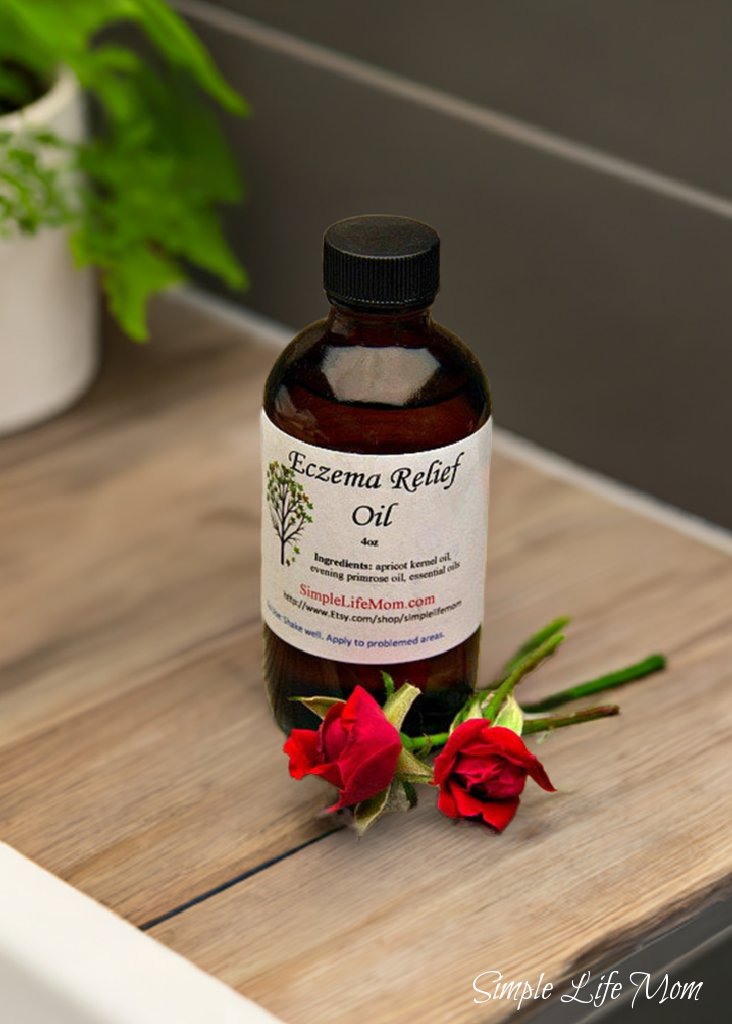 ECZEMA RELIEF OIL - 4oz soothe irritated, dry skin, organic body oil with essential oils, dermatitis oil