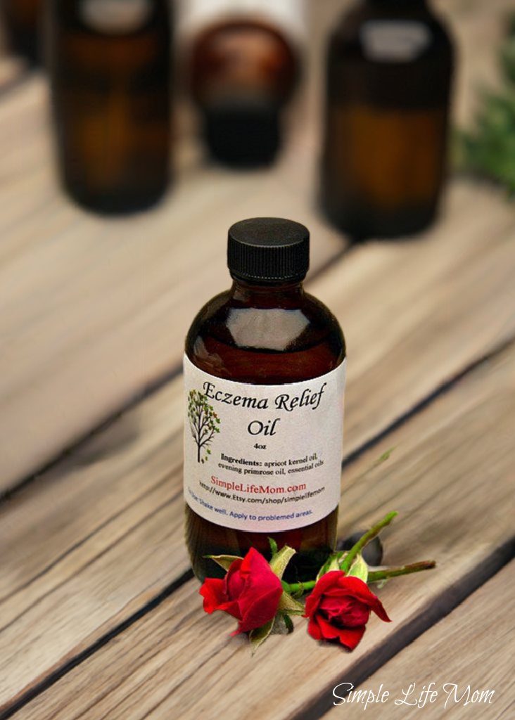 ECZEMA RELIEF OIL - 4oz soothe irritated, dry skin, organic body oil with essential oils, dermatitis oil