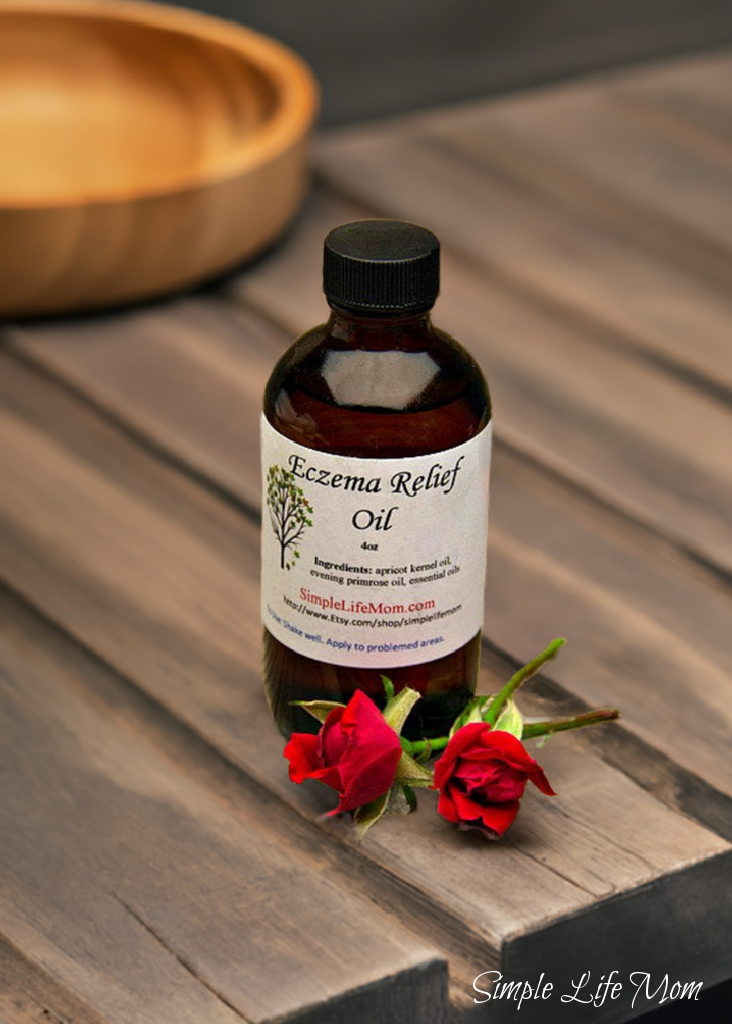 ECZEMA RELIEF OIL - 4oz soothe irritated, dry skin, organic body oil with essential oils, dermatitis oil